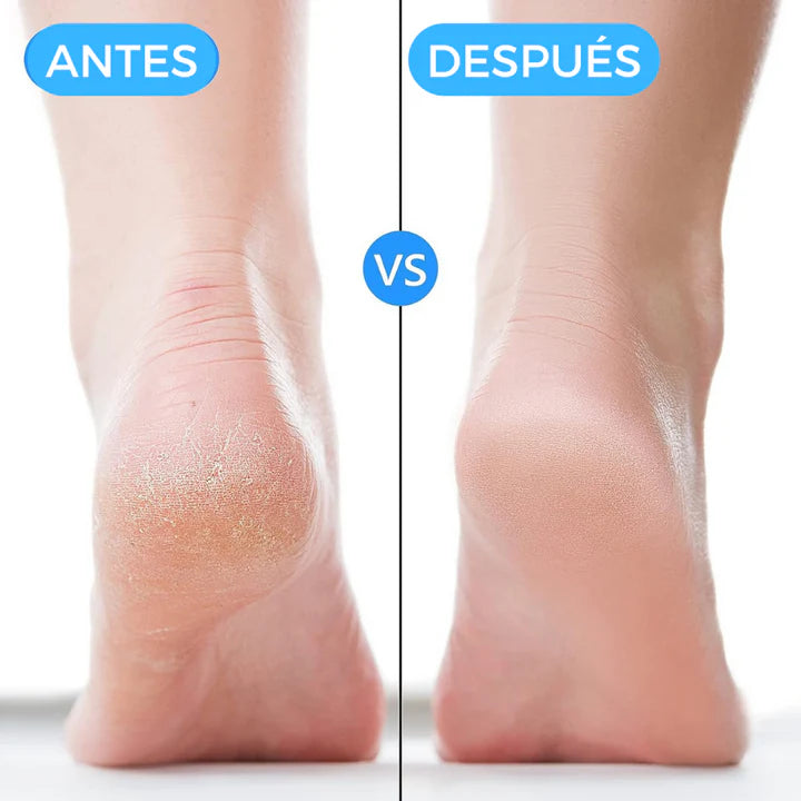 Taloneras terapéuticas transpirables