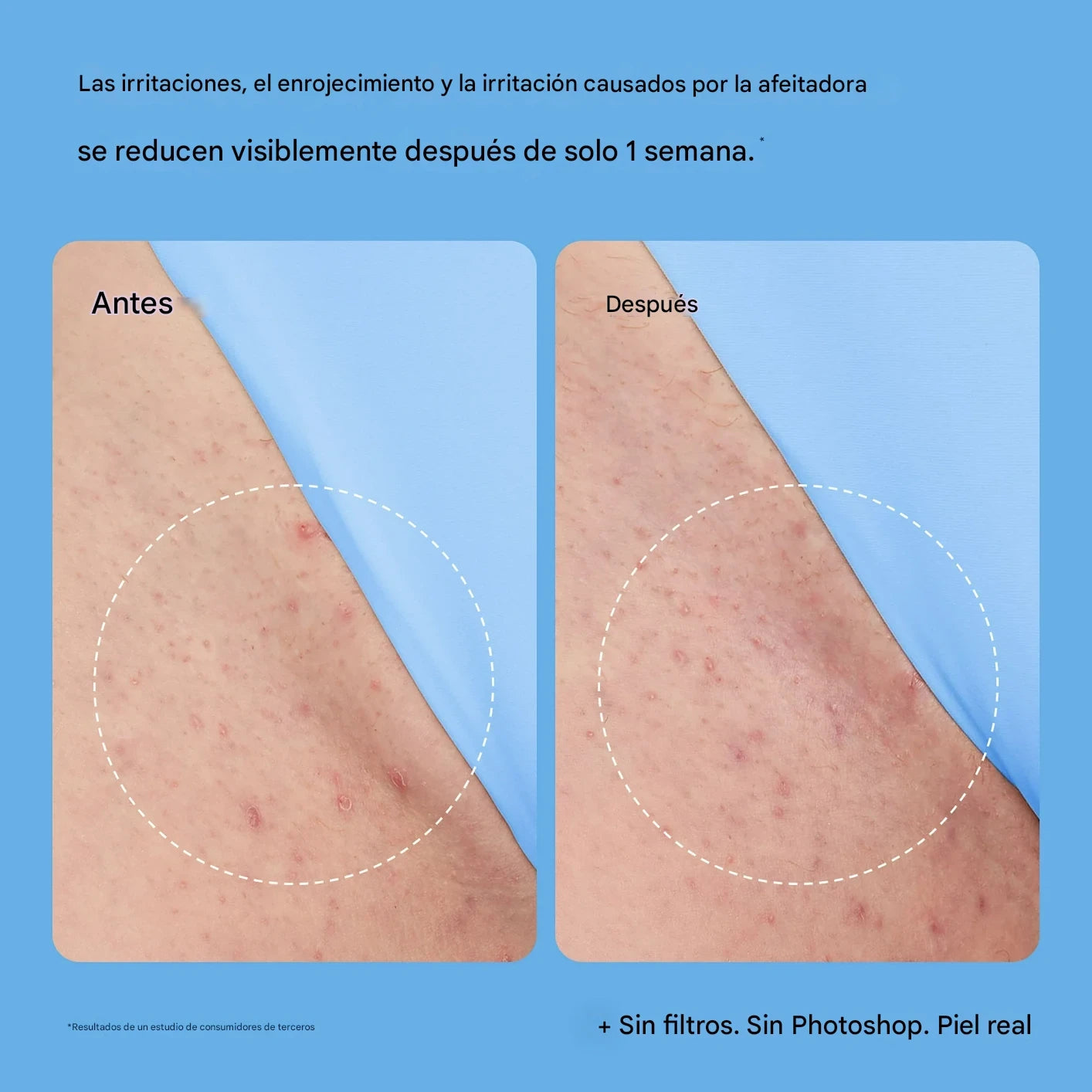 Peach Slices – Solución Suavizante para Vellos Encarnados