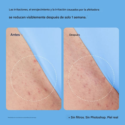 Peach Slices – Solución Suavizante para Vellos Encarnados