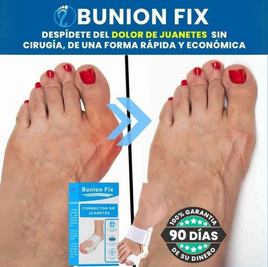 Corrector de Juanetes Bunion Fix